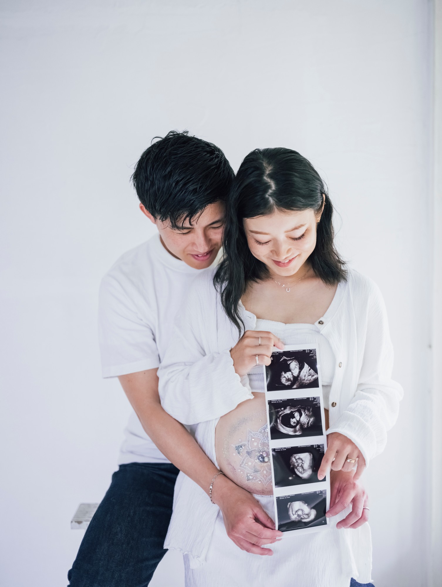 エコー写真を持ち、寄り添う夫婦
